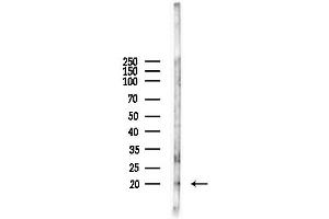 anti-Interleukin 17F (IL17F) (Internal Region) antibody