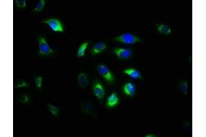 Immunofluorescence staining of A549 cells with ABIN7146512 at 1:533, counter-stained with DAPI. (Calpain S1 anticorps  (AA 1-268))