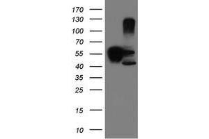 Image no. 7 for anti-serpin Peptidase Inhibitor, Clade B (Ovalbumin), Member 1 (SERPINB1) (AA 77-306) antibody (ABIN1491671)
