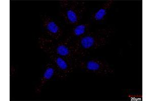 Confocal microscopy image of Proximity Ligation Assay of protein-protein interactions between PDGFRB and FLT1. (PDGFRB & FLT1 Protein Protein Interaction Antibody Pair)
