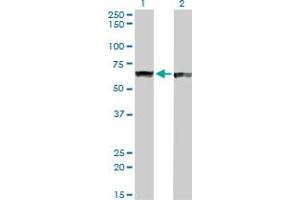 Western Blot analysis of PTBP1 expression in transfected 293T cell line by PTBP1 monoclonal antibody (M01), clone 3H8.