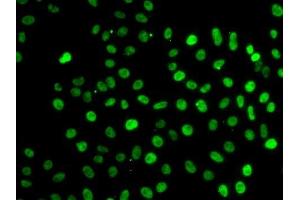 Immunofluorescence analysis of A-549 cells using SF3B2 antibody.