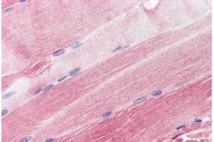 anti-Receptor-Associated Protein of The Synapse (RAPSN) (AA 395-412) antibody