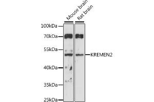 Western blot analysis of extracts of various cell lines, using KREMEN2 antibody (ABIN7268149) at 1:1000 dilution.
