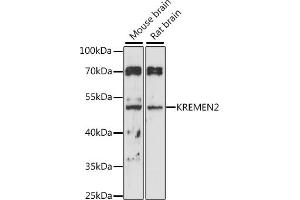 Western blot analysis of extracts of various cell lines, using KREMEN2 antibody (ABIN7268149) at 1:1000 dilution. (KREMEN2 anticorps  (AA 200-360))