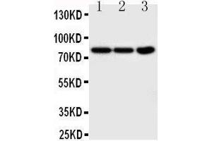 Anti-TrkA antibody,  Western blotting Lane 1: COLO320 Cell Lysate Lane 2:  Cell Lysate Lane 3: U87 Cell Lysate (TRKA anticorps  (N-Term))