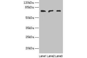 Western blot All lanes: PLCZ1 antibody at 3 μg/mL Lane 1: Mouse liver tissue Lane 2: Mouse kidney tissue Lane 3: Human placenta tissue Secondary Goat polyclonal to rabbit IgG at 1/10000 dilution Predicted band size: 71, 48, 58 kDa Observed band size: 71 kDa (PLCz1 anticorps  (AA 1-415))