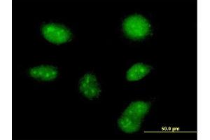 Immunofluorescence of purified MaxPab antibody to ZCCHC13 on HeLa cell. (ZCCHC13 anticorps  (AA 1-166))