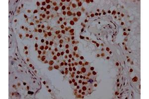 IHC image of ABIN7127661 diluted at 1:100 and staining in paraffin-embedded human testis tissue performed on a Leica BondTM system. (Recombinant PABPN1 anticorps)