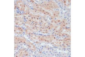Immunohistochemistry of paraffin-embedded mouse kidney using CLDN17 antibody (ABIN7266407) at dilution of 1:100 (40x lens).