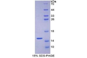 SDS-PAGE of Protein Standard from the Kit (Highly purified E. (GLUT1 Kit ELISA)