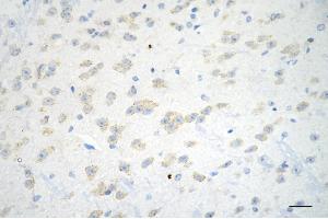 Immunohistochemistry was performed on paraffin-embedded mouse brain using ADAM17 antibody (ABIN7797502), 1:200). (Recombinant ADAM17 anticorps)