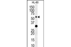 TRAF3 Antibody (C-term) (ABIN657866 and ABIN2846822) western blot analysis in HL-60 cell line lysates (35 μg/lane).