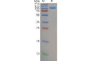 Human CD26 Protein, His Tag on SDS-PAGE under reducing condition.