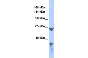 WB Suggested Anti-LRP1 Antibody Titration: 0. (LRP1 anticorps  (Middle Region))