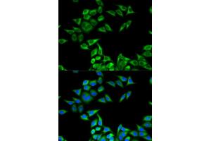 Immunofluorescence analysis of MCF-7 cells using CHMP2B antibody (ABIN6131571, ABIN6138545, ABIN6138547 and ABIN6217398). (CHMP2B anticorps  (AA 1-213))