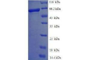 SDS-PAGE (SDS) image for Endonuclease VIII-Like 1 (NEIL1) (AA 2-390) protein (His-SUMO Tag) (ABIN5711646)