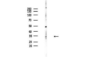 anti-Stanniocalcin 2 (STC2) (C-Term) antibody