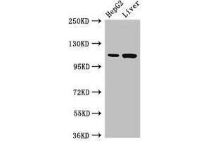 Western Blot Positive WB detected in: HepG2 whole cell lysate, Rat liver tissue All lanes: Tmprss15 antibody at 3 μg/mL Secondary Goat polyclonal to rabbit IgG at 1/50000 dilution Predicted band size: 119 kDa Observed band size: 119 kDa (TMPRSS15 anticorps  (AA 830-1069))