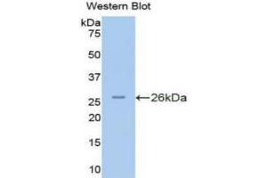 Western blot analysis of the recombinant protein. (PKN2 anticorps  (AA 282-487))