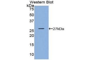 Western Blotting (WB) image for anti-Glutathione S-Transferase kappa 1 (GSTK1) (AA 19-222) antibody (ABIN1859088) (GSTK1 anticorps  (AA 19-222))