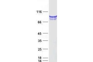 Validation with Western Blot