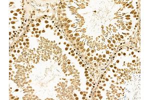 ABIN6261140 and ABIN6268860 at 1/100 staining Rat testis tissue by IHC-P. (Cyclin A1 anticorps)