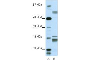 WB Suggested Anti-ZNF607 Antibody Titration:  0. (ZNF607 anticorps  (Middle Region))