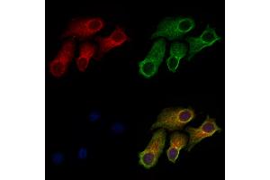 ABIN6257460 and ABIN6273388 staining HepG2 cells by IF/ICC. (RIOK2 anticorps  (Internal Region))