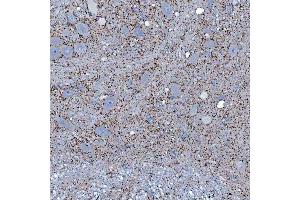 IHC analysis of SFXN5 using anti-SFXN5 antibody (ABIN7601388). (Sideroflexin 5 anticorps  (AA 34-340))