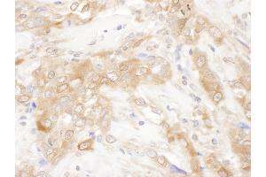 anti-Charged Multivesicular Body Protein 2B (CHMP2B) (AA 163-213) antibody