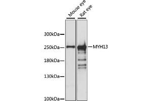 Western blot analysis of extracts of various cell lines, using MYH13 antibody (ABIN7268746) at 1:1000 dilution. (MYH13 anticorps  (AA 1240-1320))