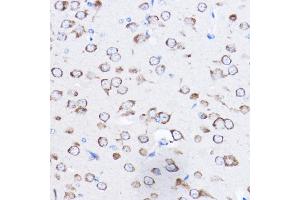 Immunohistochemistry of paraffin-embedded mouse brain using RPL8 Rabbit pAb (ABIN6128659, ABIN6147155, ABIN6147156 and ABIN6214154) at dilution of 1:50 (40x lens). (RPL8 anticorps  (AA 1-257))