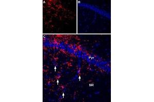 Expression of P2RX7 in rat hippocampus - Immunohistochemical staining of rat hippocampus frozen section using Anti-P2X7 Receptor-ATTO Fluor-550 Antibody (ABIN7043577), (1:60). (P2RX7 anticorps  (C-Term, Intracellular) (Atto 550))