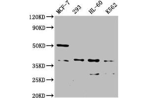 Western Blot Positive WB detected in: MCF-7 whole cell lysate, 293 whole cell lysate, HL60 whole cell lysate, K562 whole cell lysate All lanes: MRGPRX2 antibody at 1:2000 Secondary Goat polyclonal to rabbit IgG at 1/50000 dilution Predicted band size: 38 kDa Observed band size: 38 kDa (MRGPRX2 anticorps  (AA 286-330))