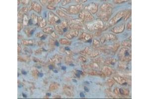 Used in DAB staining on fromalin fixed paraffin- embedded kidney tissue