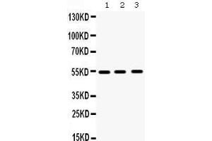 Western Blotting (WB) image for anti-Matrix Metallopeptidase 10 (Stromelysin 2) (MMP10) (AA 409-443), (C-Term) antibody (ABIN3043406)