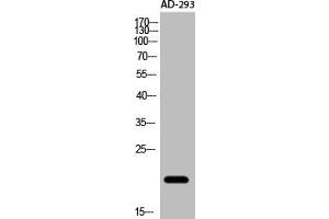 Western Blot analysis of AD-293 cells using Acetyl-NF-E4 (K43) Polyclonal Antibody