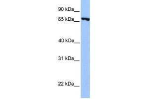 WB Suggested Anti-PRDM6 Antibody Titration:  0. (PRDM6 anticorps  (N-Term))