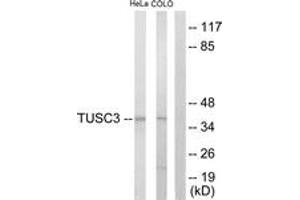 Western blot analysis of extracts from COLO205/HeLa cells, using TUSC3 Antibody. (TUSC3 anticorps  (AA 131-180))