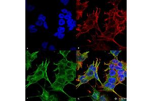 Immunocytochemistry/Immunofluorescence analysis using Mouse Anti-GluN2A/NR2A Monoclonal Antibody, Clone S327-95 . (NMDAR2A anticorps  (AA 75-325) (Biotin))