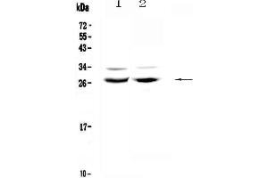 Western blot analysis of Mad using anti-Mad antibody . (MXD1 anticorps  (AA 1-221))