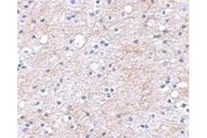 Immunohistochemical staining of human brain tissue using LGI1 polyclonal antibody  at 2. (LGI1 anticorps  (Internal Region))