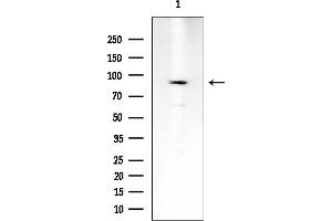 Western blot analysis of lysates from PC12 cells, using TCIRG1 Mouse Monoclonal Antibody at 1/1000 dilution.