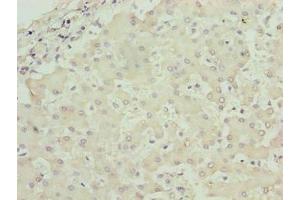 Immunohistochemistry of paraffin-embedded human liver tissue using ABIN7142833 at dilution of 1:100
