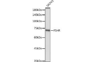 Western blot analysis of extracts of SKOV3 cells, using FSHR antibody (ABIN3022001, ABIN3022002, ABIN3022003, ABIN1512927 and ABIN6218564) at 1:1000 dilution. (FSHR anticorps  (AA 631-695))