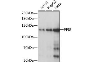 Western blot analysis of extracts of various cell lines, using PPIG antibody (ABIN1513403, ABIN3020977, ABIN3020978 and ABIN6213843) at 1:1000 dilution. (PPIG anticorps  (AA 1-100))