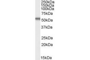 Image no. 1 for anti-Early Growth Response 2 (EGR2) (Internal Region) antibody (ABIN375194) (EGR2 anticorps  (Internal Region))