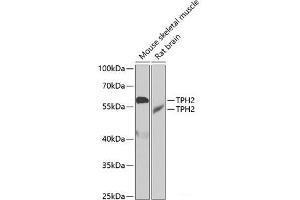 Western blot analysis of extracts of various cell lines using TPH2 Polyclonal Antibody at dilution of 1:1000. (Tryptophan Hydroxylase 2 anticorps)
