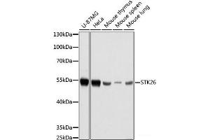 Western blot analysis of extracts of various cell lines using STK26 Polyclonal Antibody at dilution of 1:1000. (STK26/MST4 anticorps)